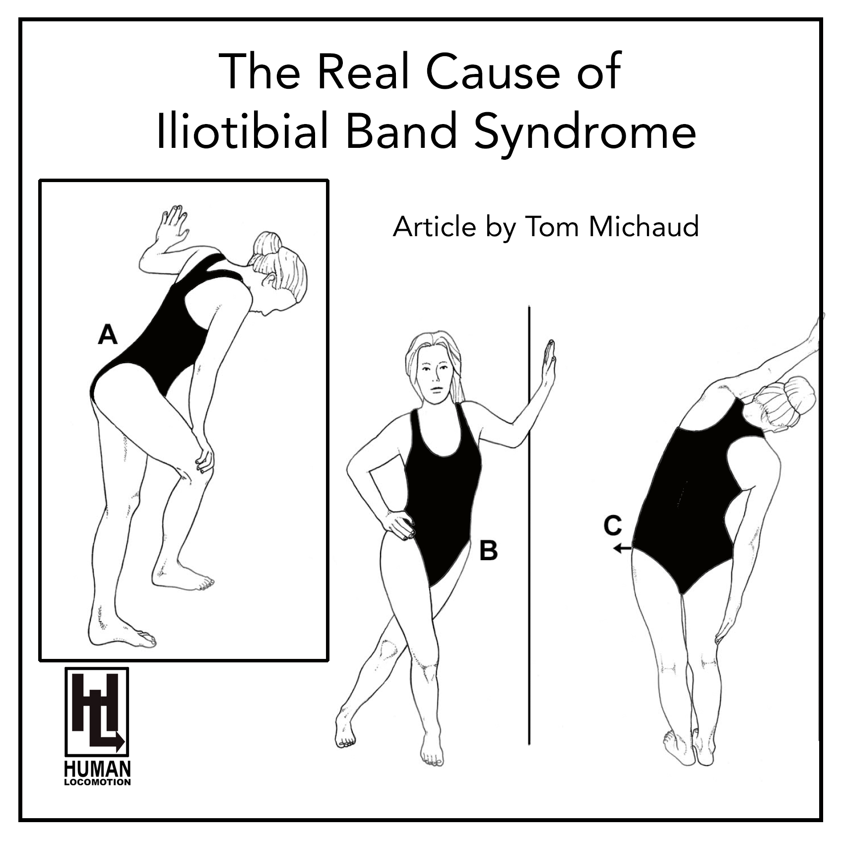 The Real Cause of Iliotibial Band Syndrome