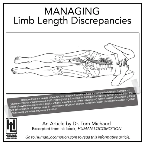 Managing Limb Length Discrepancies