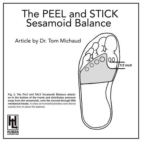 The Peel and Stick Sesamoid Balance