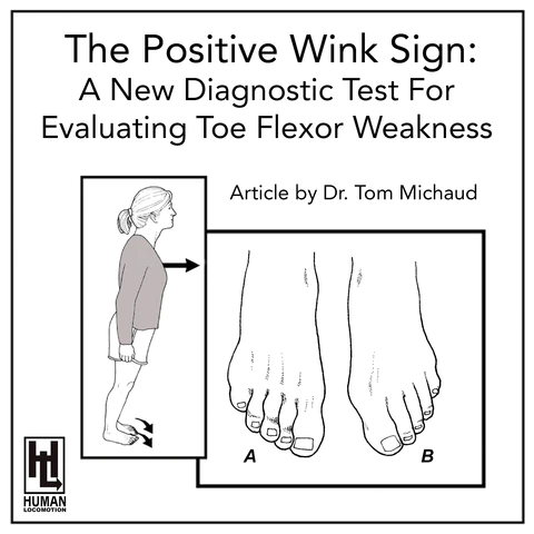 The Positive Wink Sign: A New Diagnostic Test for Evaluating Toe Flexor Weakness