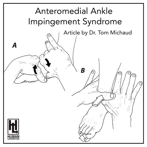 Anteromedial Ankle Impingement Syndrome