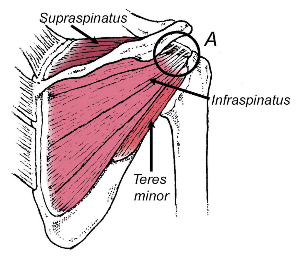 Does a Torn Rotator Cuff Really Require Surgery? - Human Locomotion