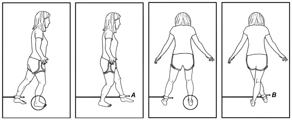 How to Rehab a Sprained Ankle - Human Locomotion