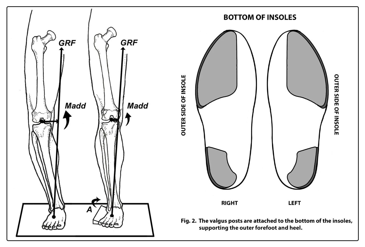 PEEL and STICK POSTS Forefoot and Rearfoot Valgus Posts Human