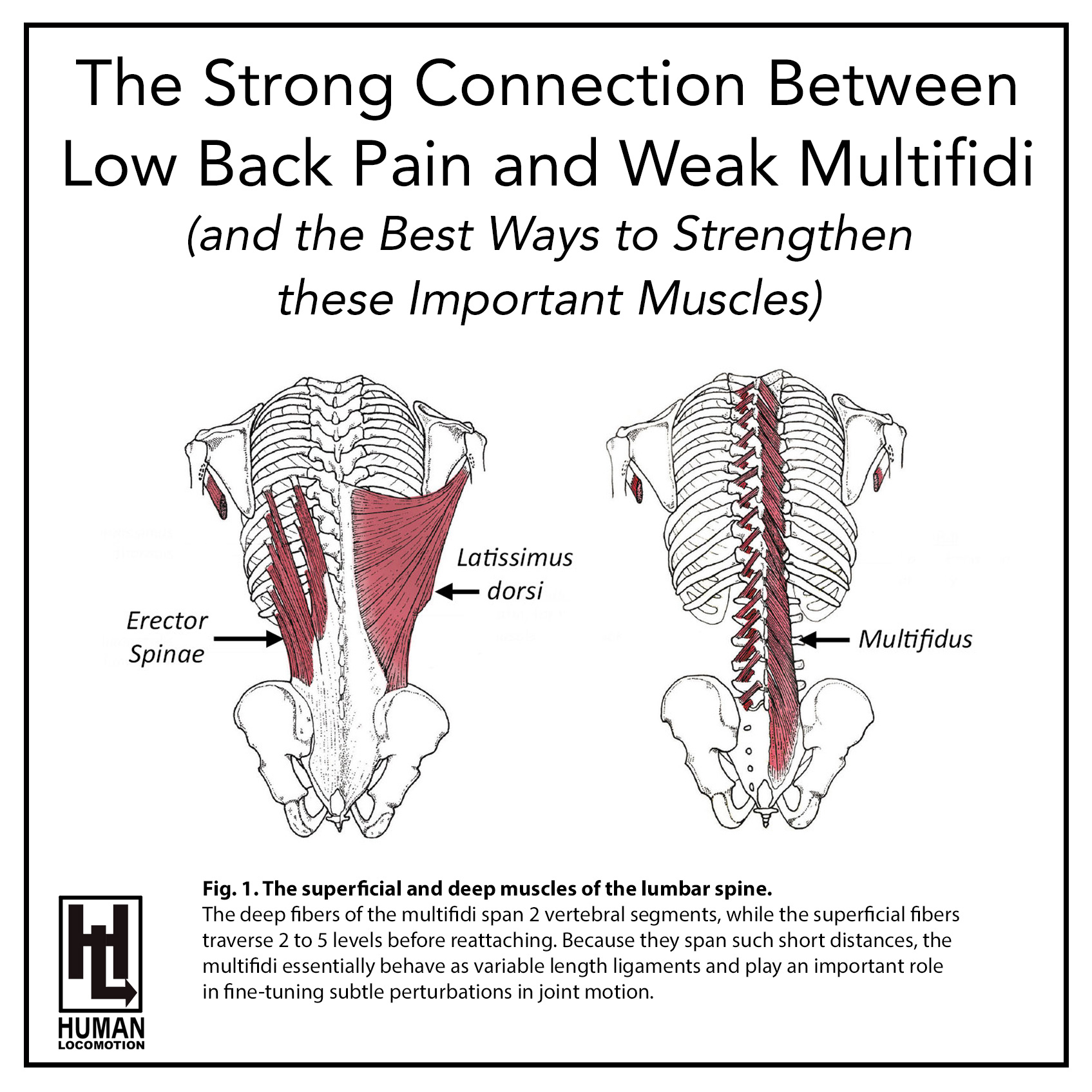 The Strong Connection BetweenLow Back Pain and Weak Multifidi(and the Best Ways to Strengthen these Important Muscles)