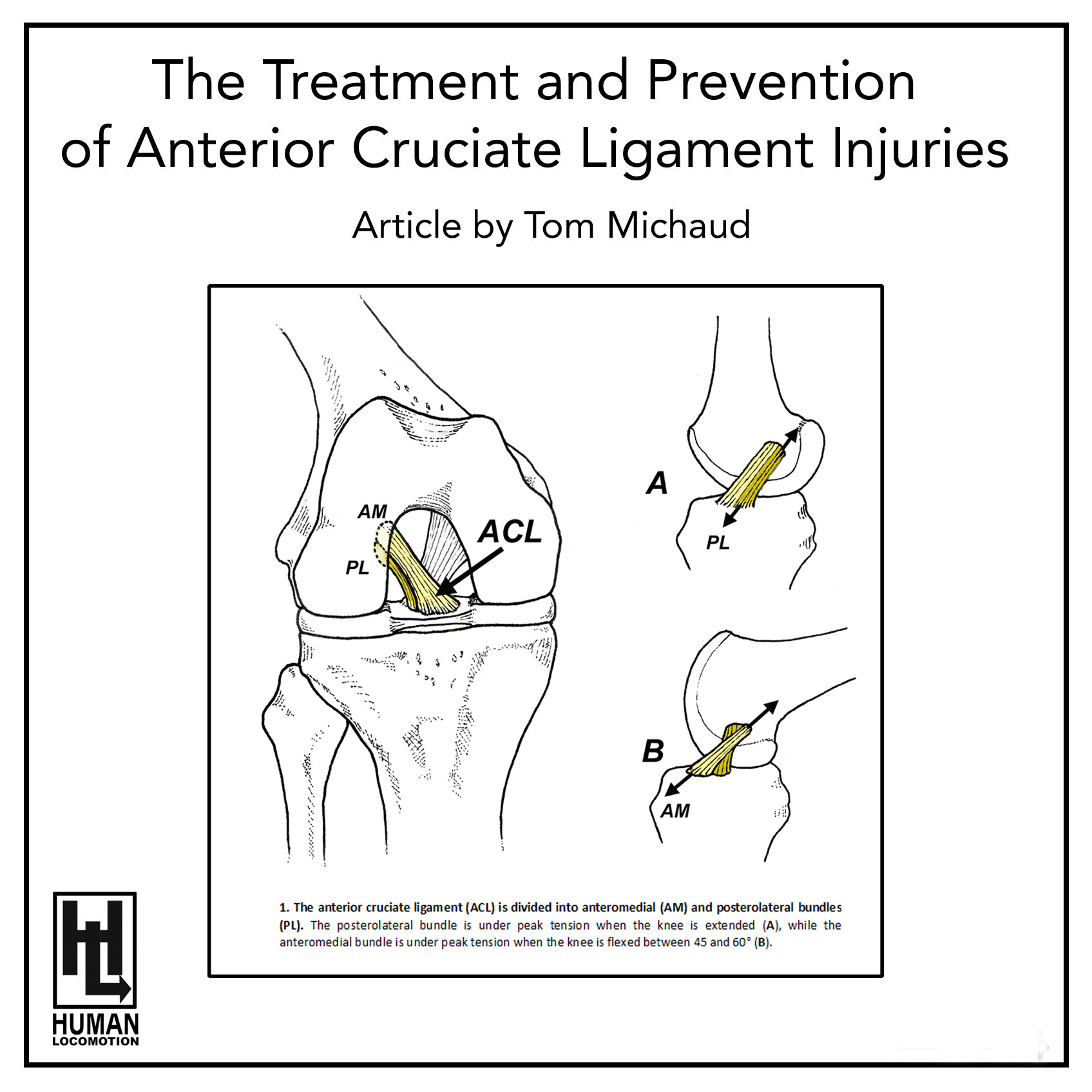 The Treatment and Prevention of Anterior Cruciate Ligament Injuries