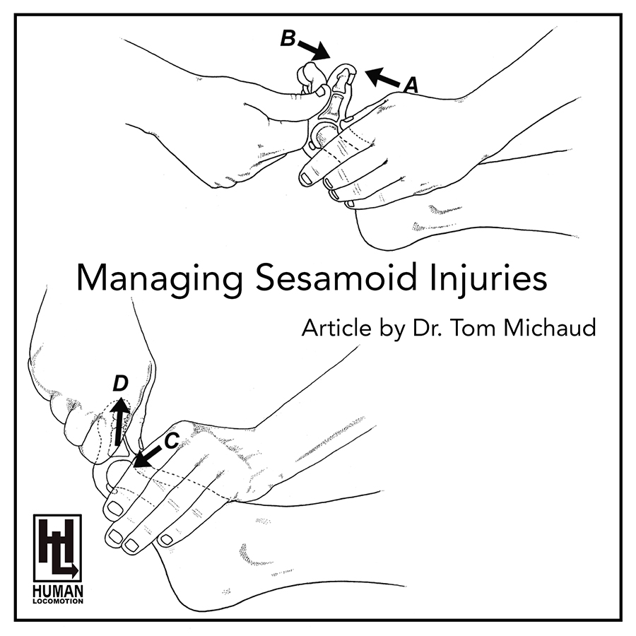 Managing Sesamoid Injuries