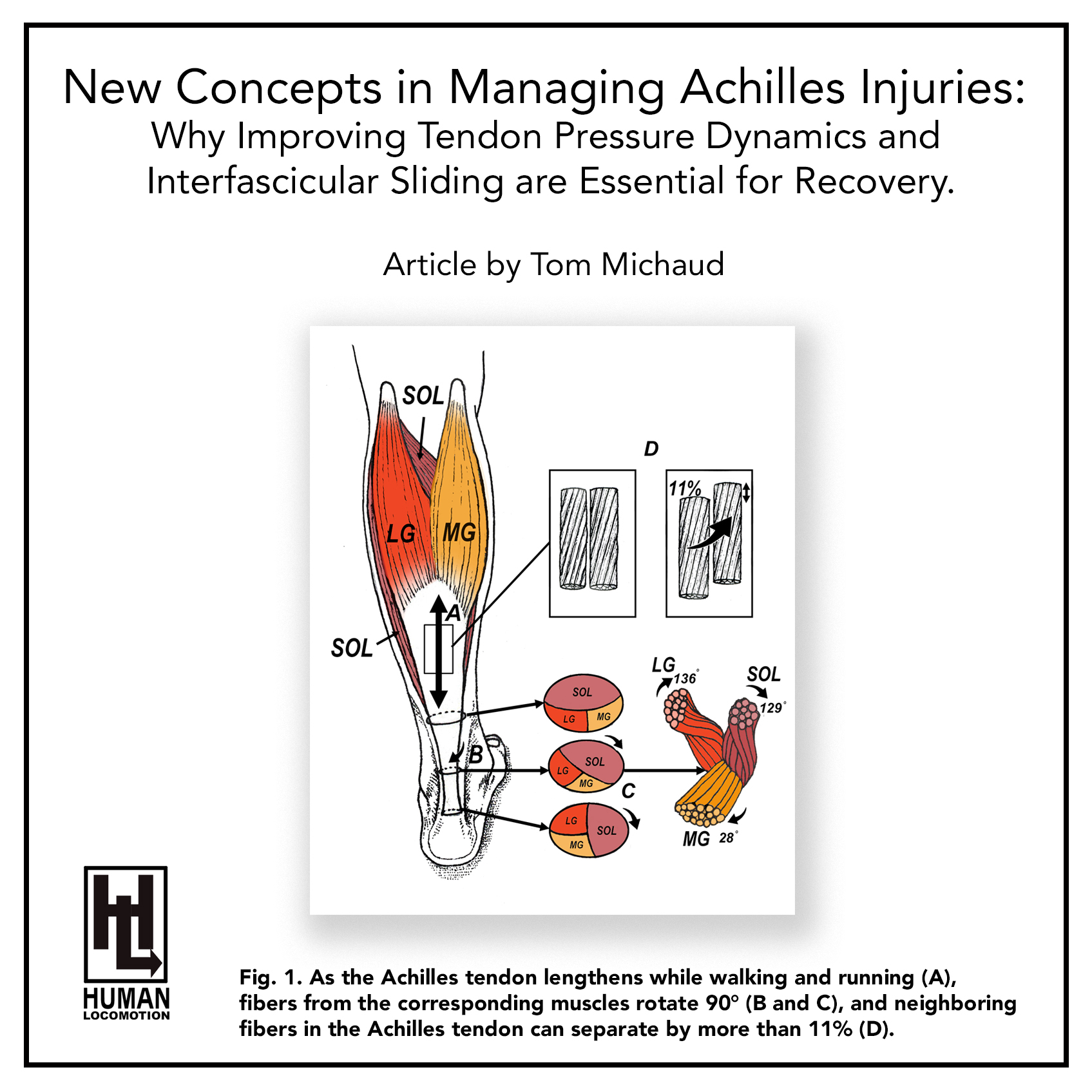 New Concepts in Managing Non-Insertional Achilles Injuries: Why Improving Tendon Pressure Dynamics and Interfascicular Sliding Are Essential for Recovery.