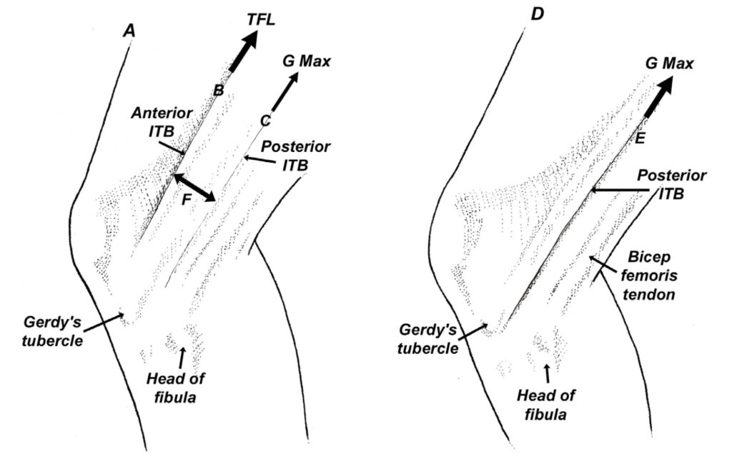 Iliotibial Band Syndrome - Active650