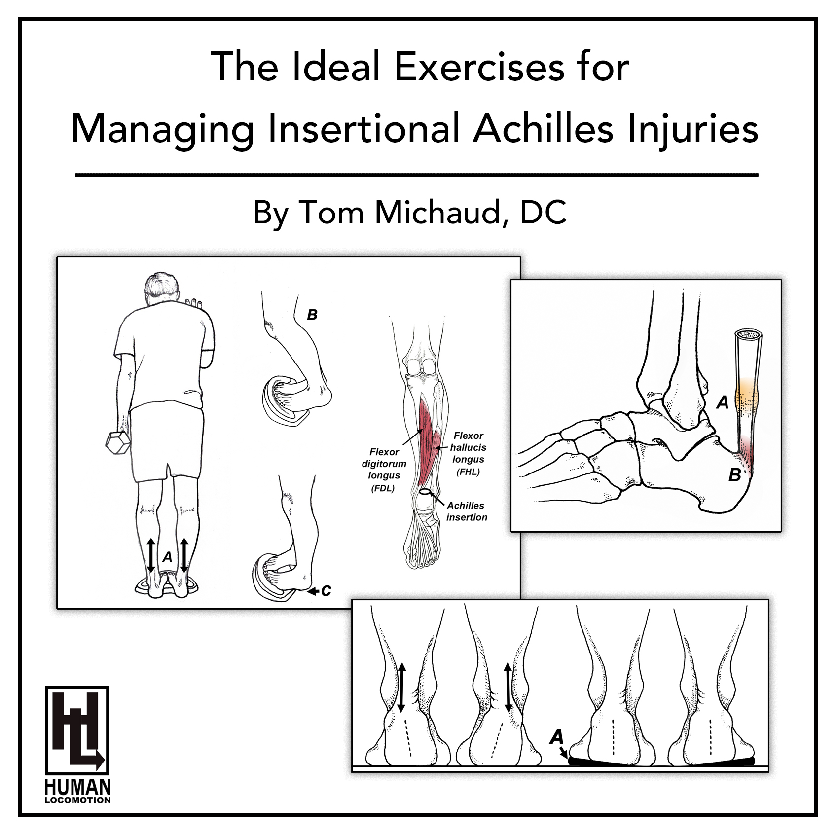 The Ideal Exercises for Managing Insertional Achilles Injuries