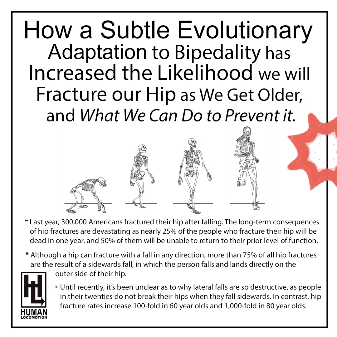How a Subtle Evolutionary Adaptation to Bipedality has Increased the Likelihood we will Fracture our Hip as We Get Older, and What We Can do to Prevent it.