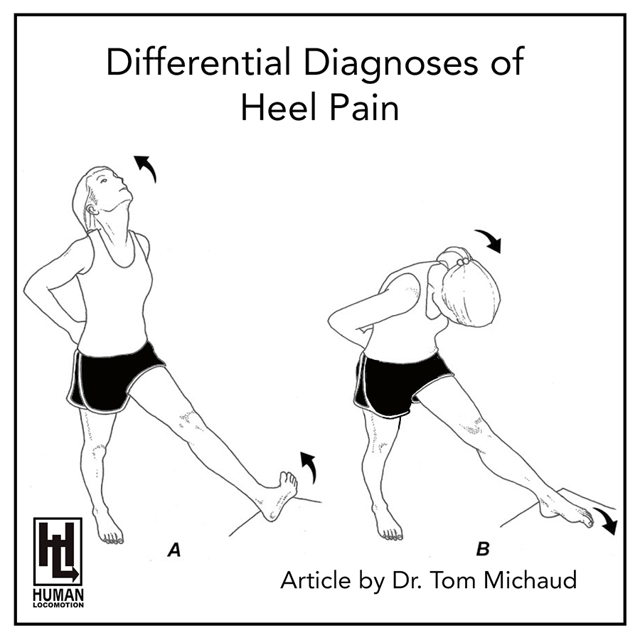 Differential Diagnoses of Heel Pain