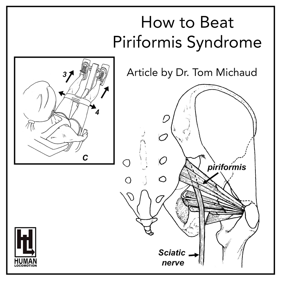 How To Beat Piriformis Syndrome