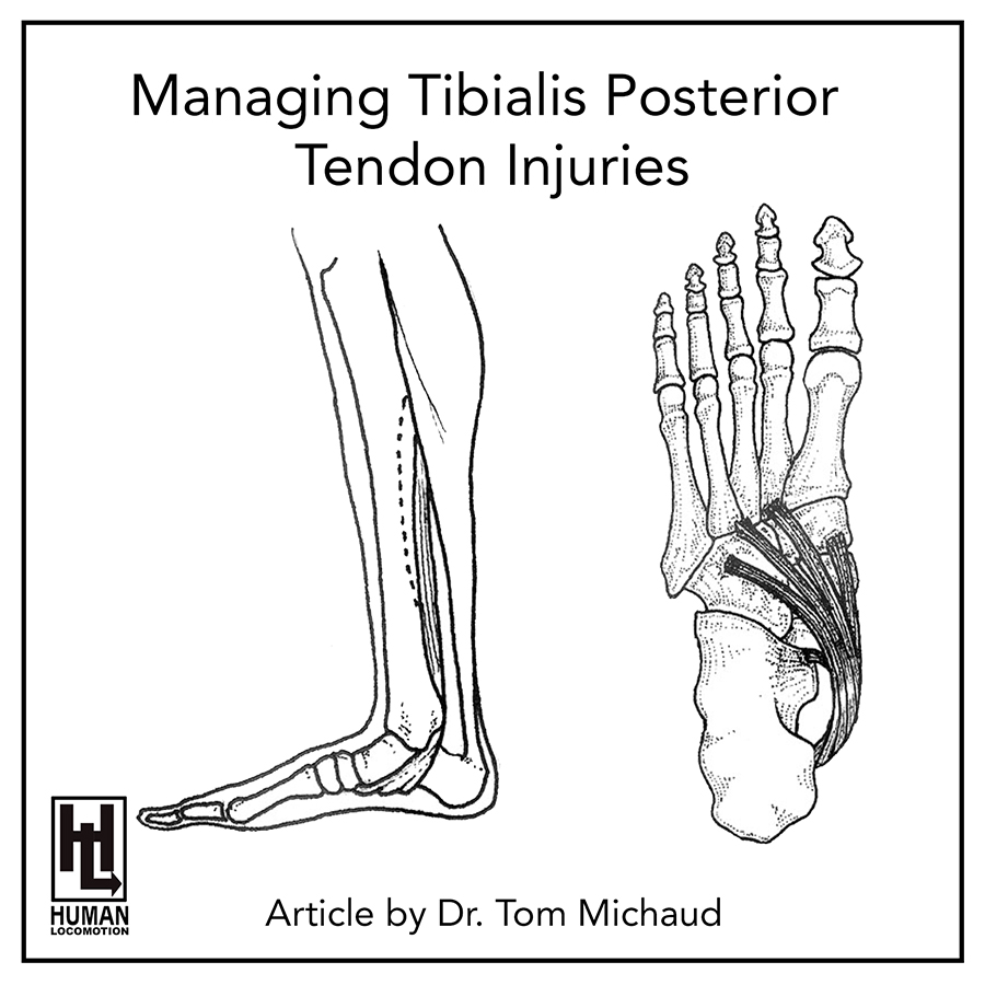 Managing Tibialis Posterior Tendon Injuries