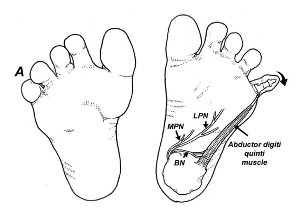 Differential Diagnoses of Heel Pain Human