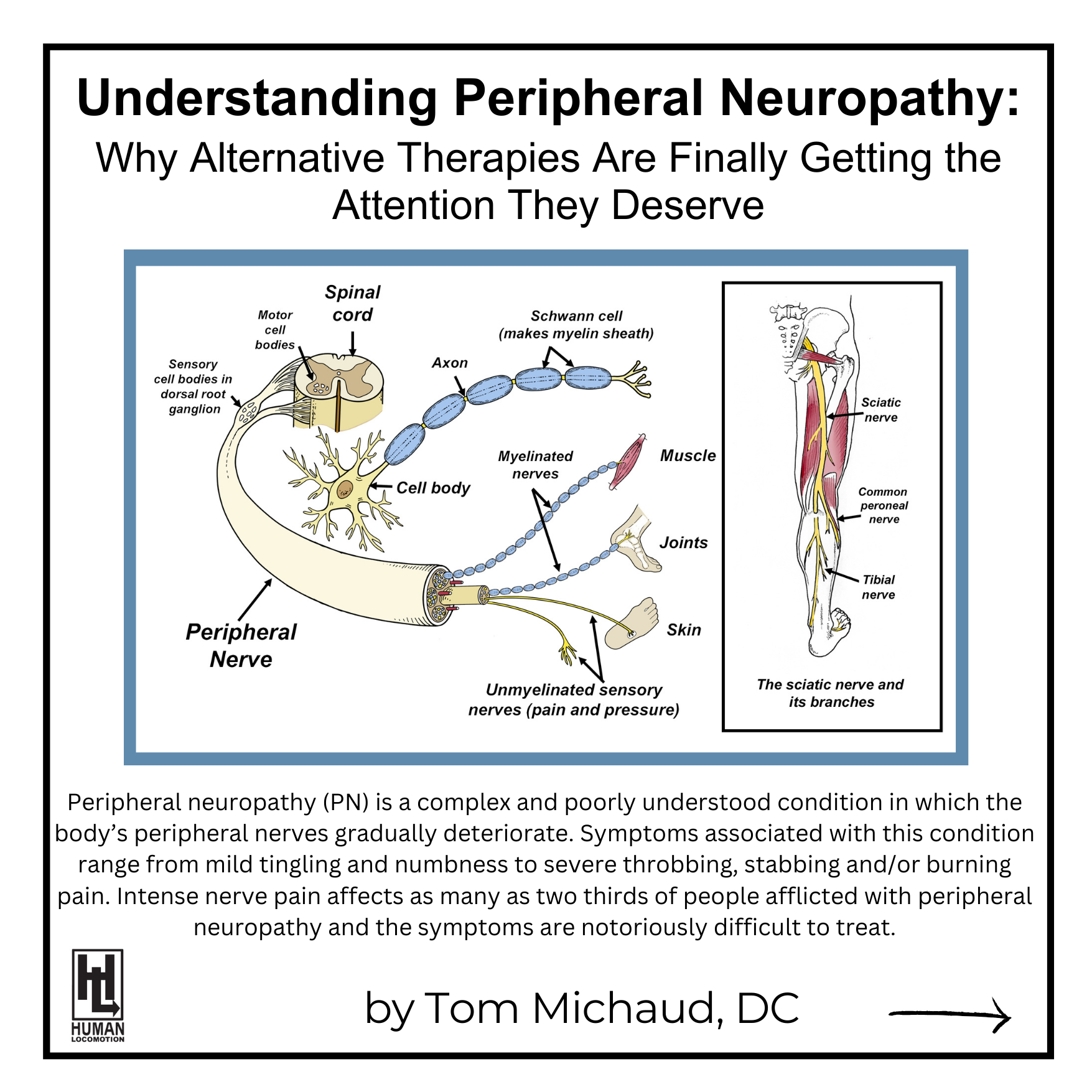 Understanding Peripheral Neuropathy: Why Alternative Therapies Are Finally Getting the Attention They Deserve