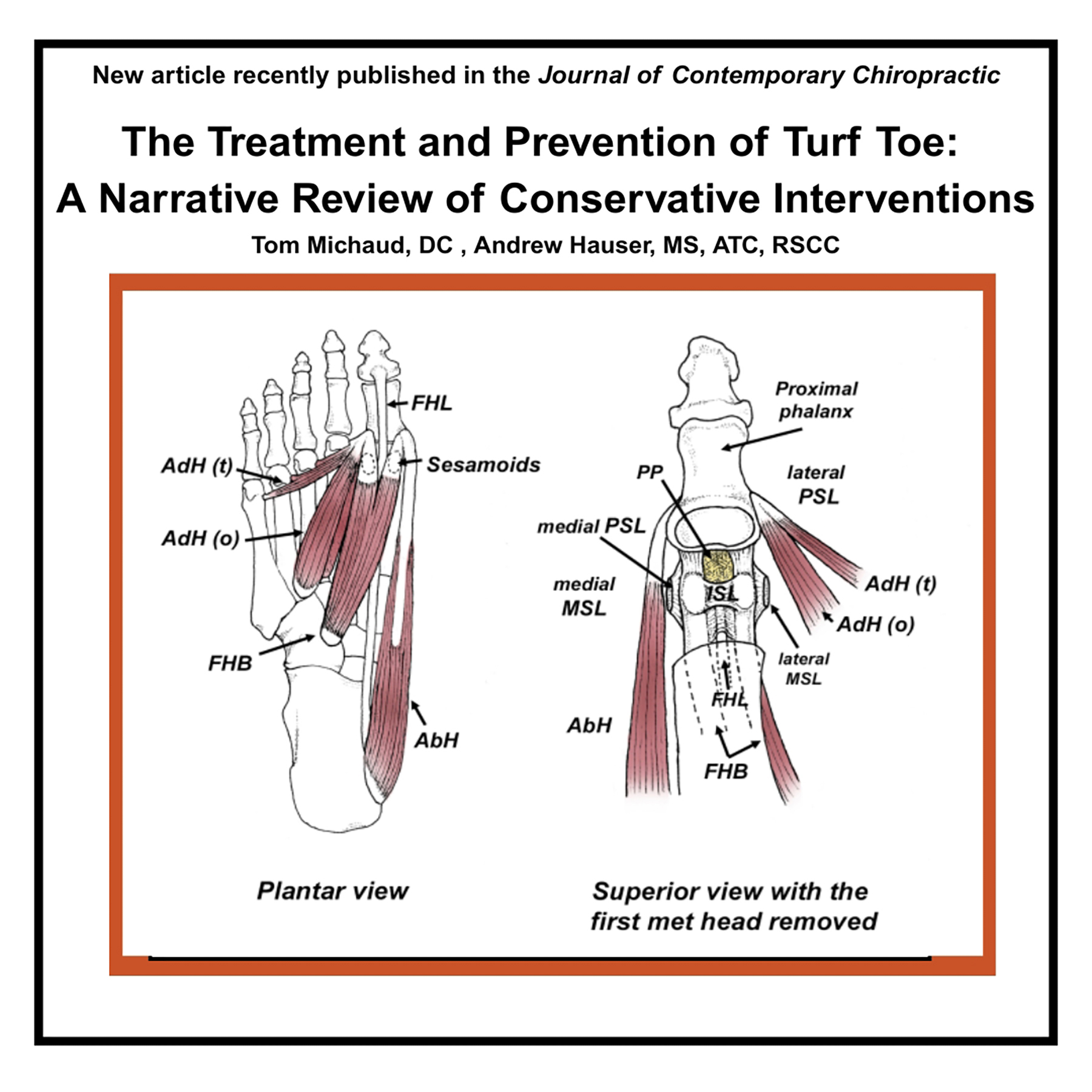 The Treatment and Prevention of Turf Toe: A Narrative Review of ...